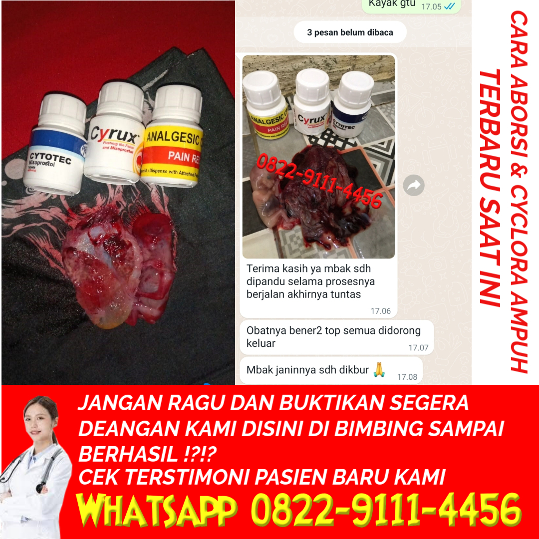 caramenggugurkankandungandenganalami